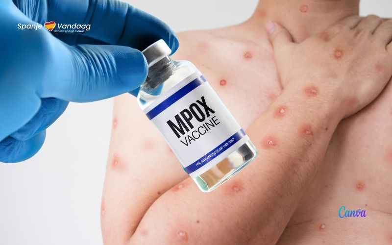 De huidige situatie van Mpox of apenpokken in het meest getroffen EU-land Spanje